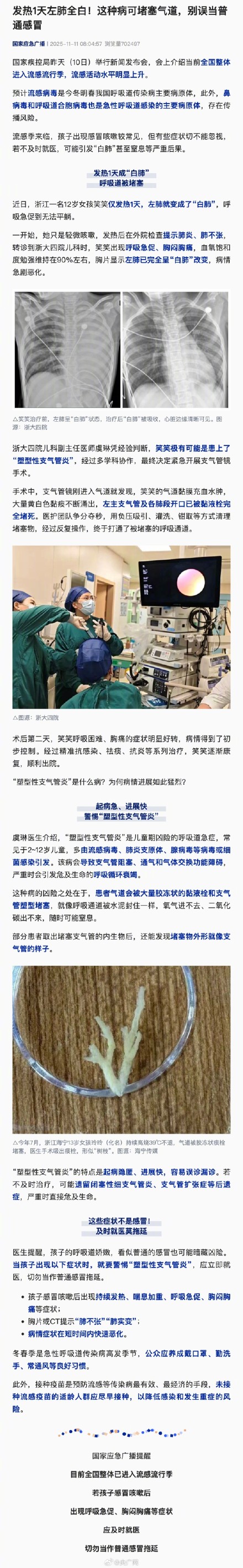 发热1天变白肺 这病别误当普通感冒