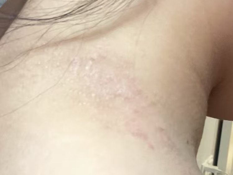 发红发痒，耳朵肿成“招风耳”！医院一查懵了，“元凶”竟是这种常见的小东西