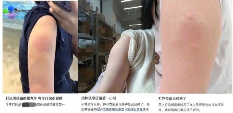打完疫苗到底能不能洗澡？胳膊肿起来了怎么办？