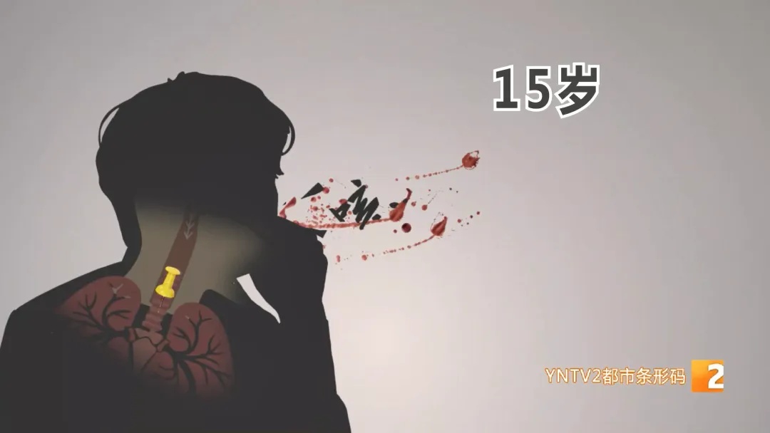 25岁小伙咳嗽带血10年！原来…… 气管里竟藏着铁钉！