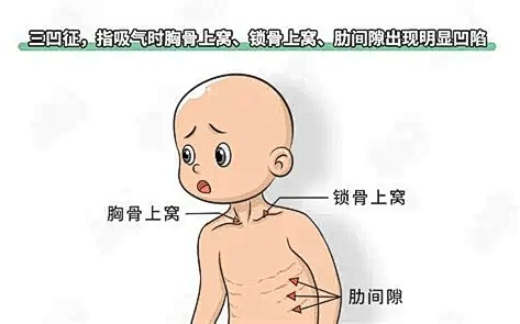 这波甲流专挑孩子“下手”！出现4个征兆恐是重症前兆