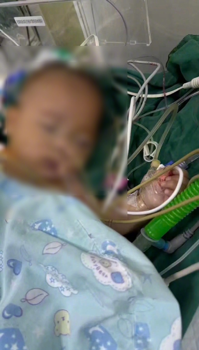 5个月女婴手术后离世!母亲质疑医生术前判断有误,当地深夜通报 5个月女婴手术后离世!母亲质疑医生术前判断有误,当地深夜通报