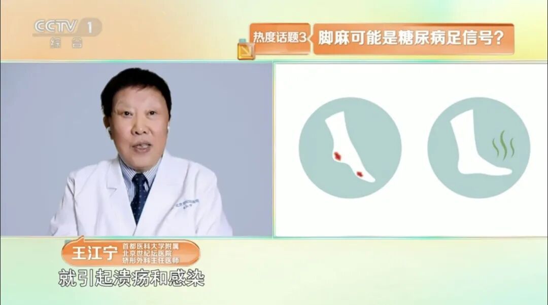 双脚是全身健康的“放大镜”！快看看你的脚，有这5个症状可能是疾病发出的信号！