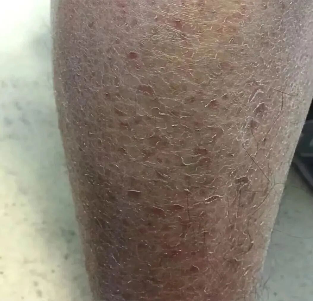 冬天,多久洗一次澡最好? 冬天,多久洗一次澡最好?