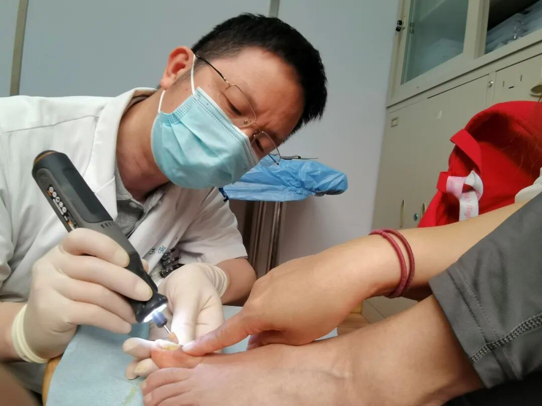 男子百思不得其解，像是被”容嬷嬷”一直跟着，时不时就往指甲里扎两针！