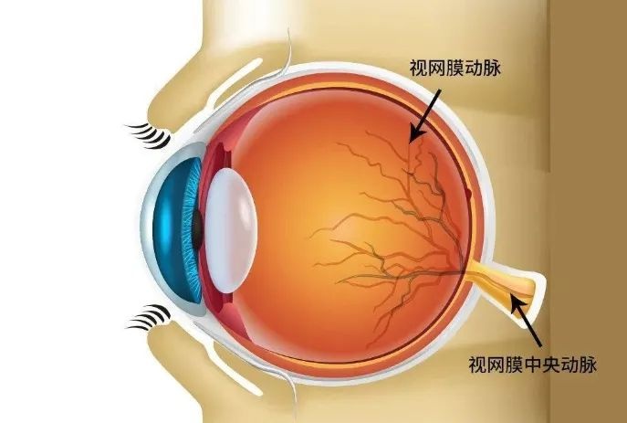 “眼睛突然看不见了！”这病进入易发季，抢救窗口仅90分钟