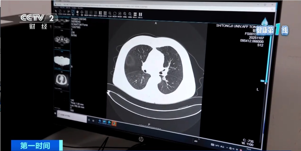 “超一半病人发现即中晚期”!我国近1亿人中招!警惕“沉默的杀手” “超一半病人发现即中晚期”!我国近1亿人中招!警惕“沉默的杀手”