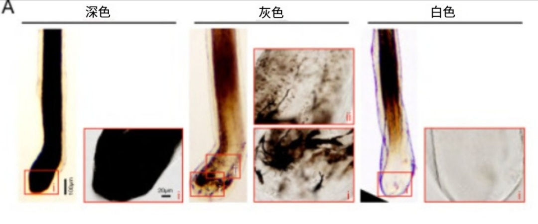 突然长了白头发别着急!重新变黑的方法找到了逆转速度惊人 突然长了白头发别着急!重新变黑的方法找到了逆转速度惊人