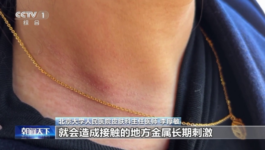 一级致癌物超标9000多倍！这些饰品严重影响健康，已有多人中招