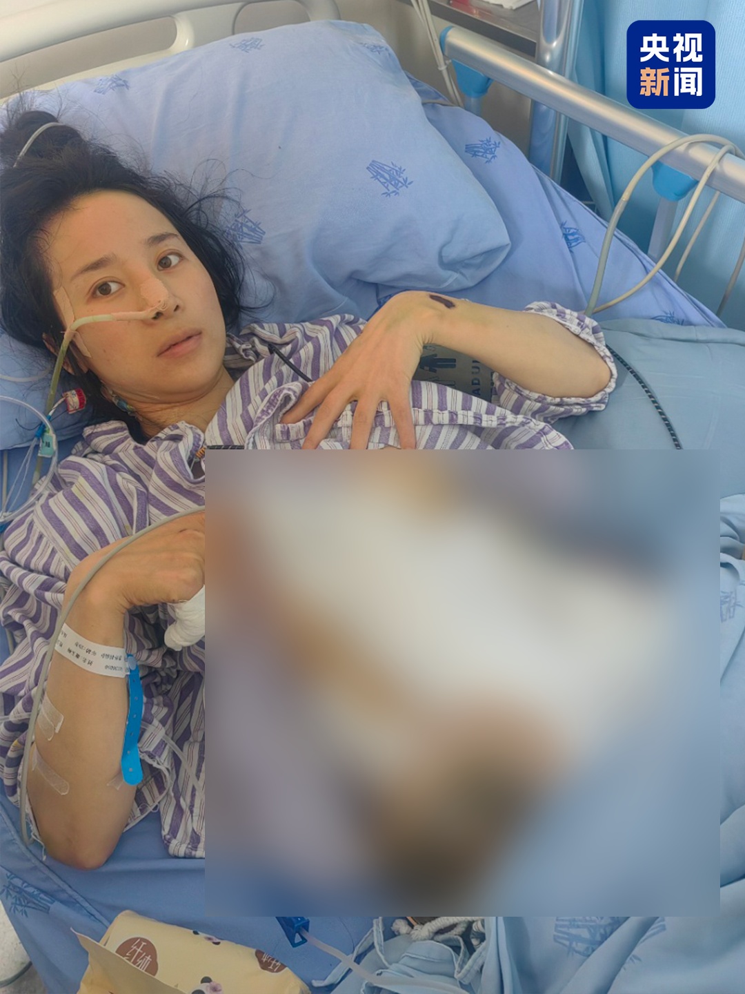 结婚两年遭遇多次家暴，4处重伤！受害者是否走出阴霾？