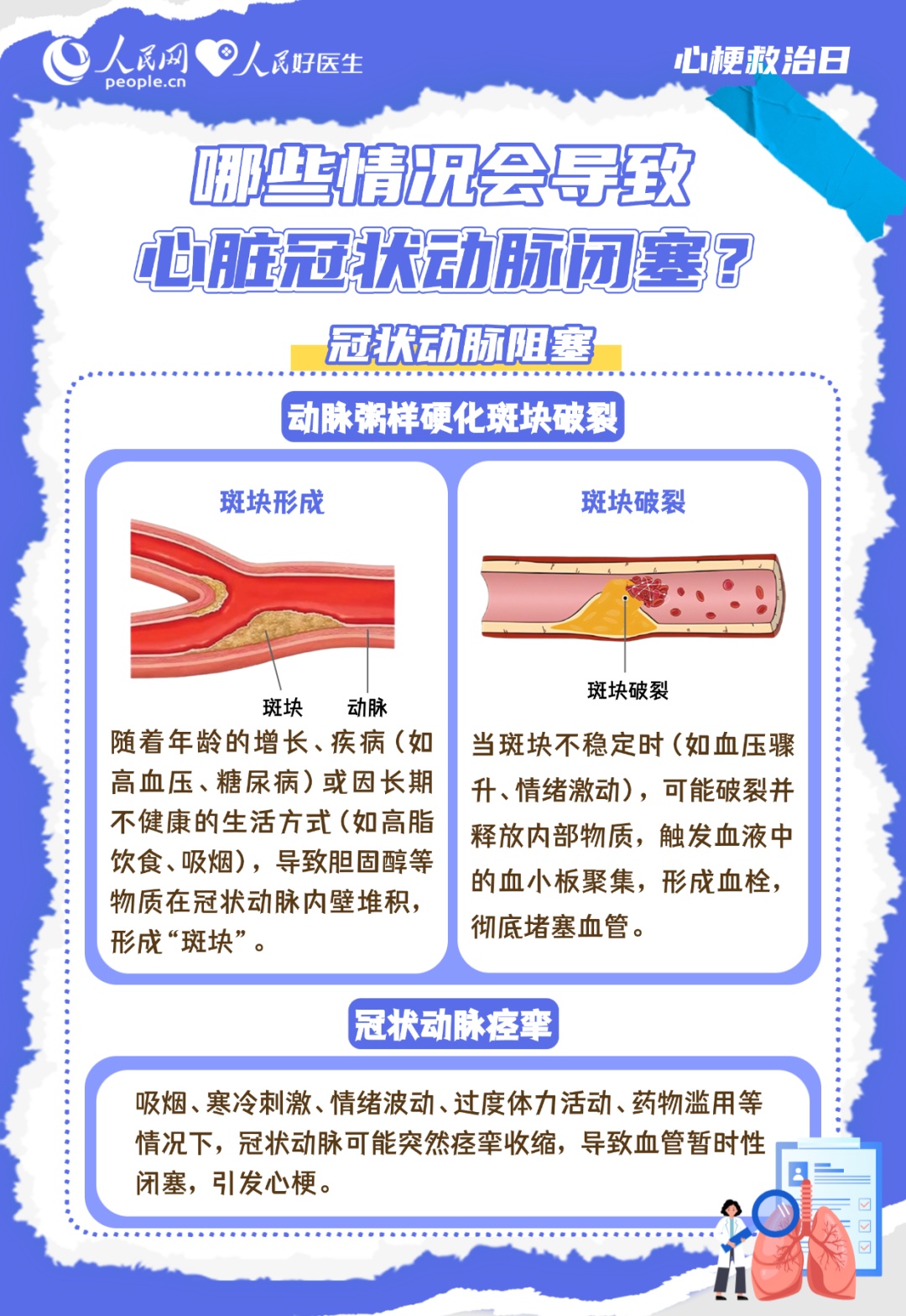 看懂心梗信号 掌握健康主动权