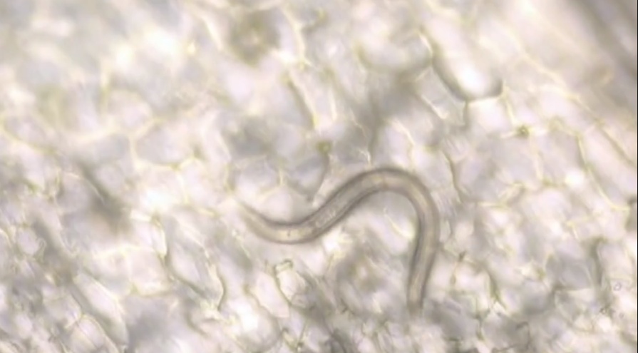 江苏多人因食用淡水生鱼片感染肝吸虫