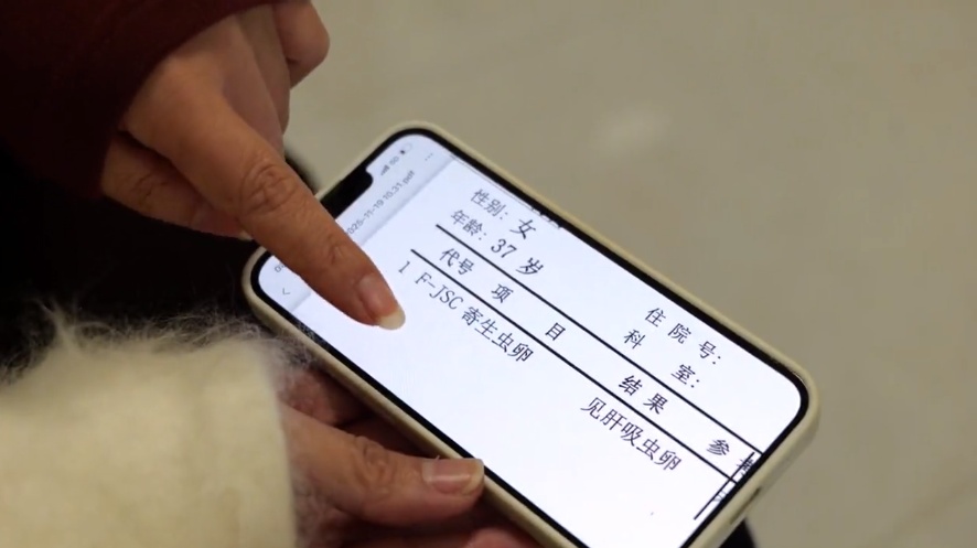 江苏多人因食用淡水生鱼片感染肝吸虫