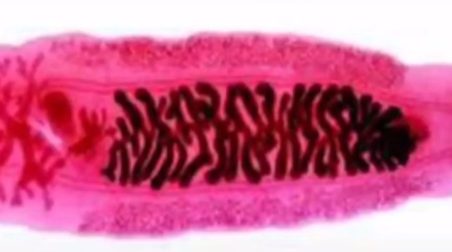 江苏多人因食用淡水生鱼片感染肝吸虫