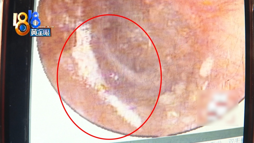 杭州姑娘痒了一整夜,检查结果让她崩溃……浴场回应索赔:凭什么要两千? 杭州姑娘痒了一整夜,检查结果让她崩溃……浴场回应索赔:凭什么要两千?