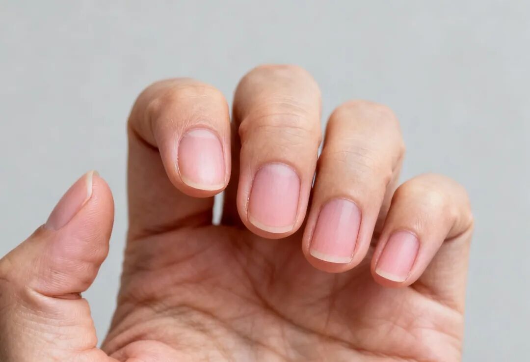 指甲上月牙少=不健康？白斑是疾病信号？别慌！这4种情况才真的要警惕