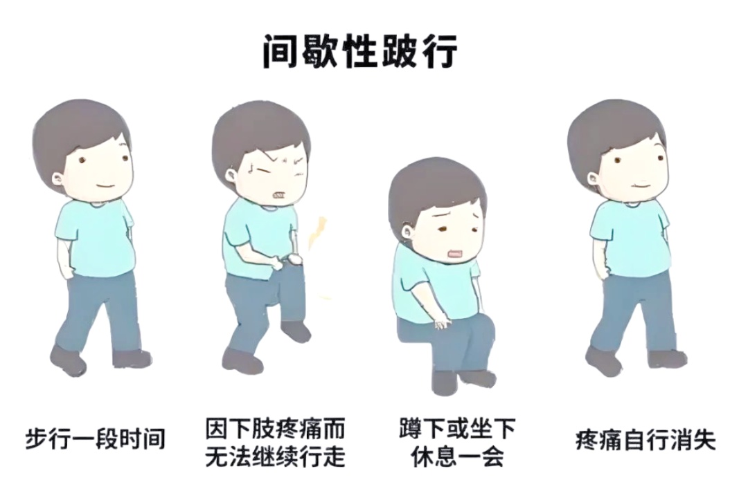 别把腰疼当小事!一种是“越走越疼”,一种是“休息也疼”,辨清病因是关键 别把腰疼当小事!一种是“越走越疼”,一种是“休息也疼”,辨清病因是关键