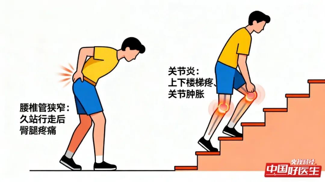 别把腰疼当小事!一种是“越走越疼”,一种是“休息也疼”,辨清病因是关键 别把腰疼当小事!一种是“越走越疼”,一种是“休息也疼”,辨清病因是关键