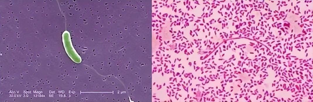 一男子处理海鲜时不小心被扎伤，几天后突然去世！处理海鲜的致命雷区，很多人不知道