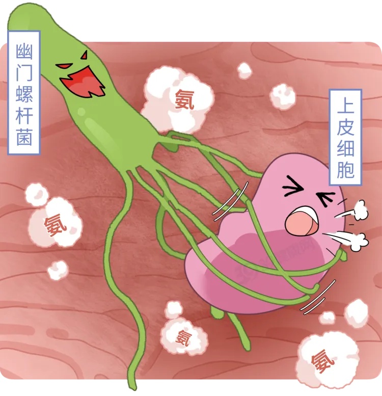 体重达200斤，长期不吃早餐，27岁小伙两次患胃癌！医生：这是重要诱因