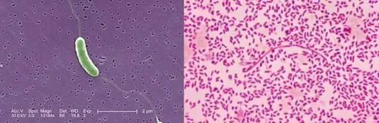 被扎了一下手，几天后不幸离世！注意：处理海鲜时，这些细节能保命