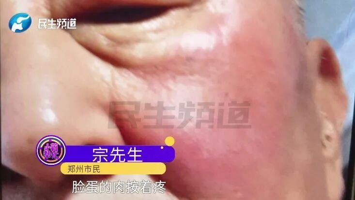快停下！严重可致血管破裂，很多人都有这个习惯