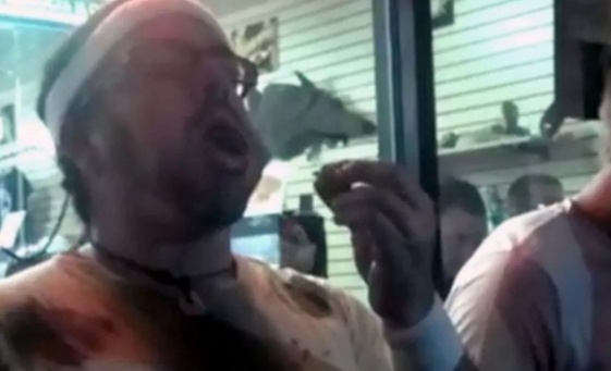 美国一男子为赢比赛狂吞几十只蟑螂憋死,法医:蟑螂碎片阻塞气道 美国一男子为赢比赛狂吞几十只蟑螂憋死,法医:蟑螂碎片阻塞气道