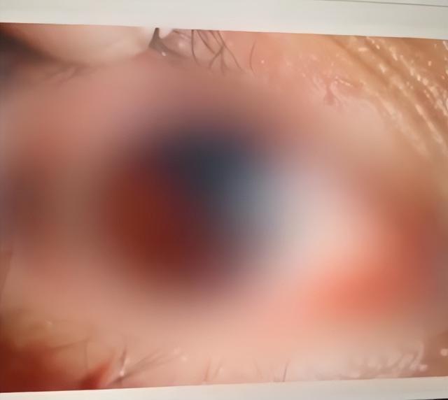 保温杯里放这几样东西，当心秒变“炸弹”！第一种很多人都放过