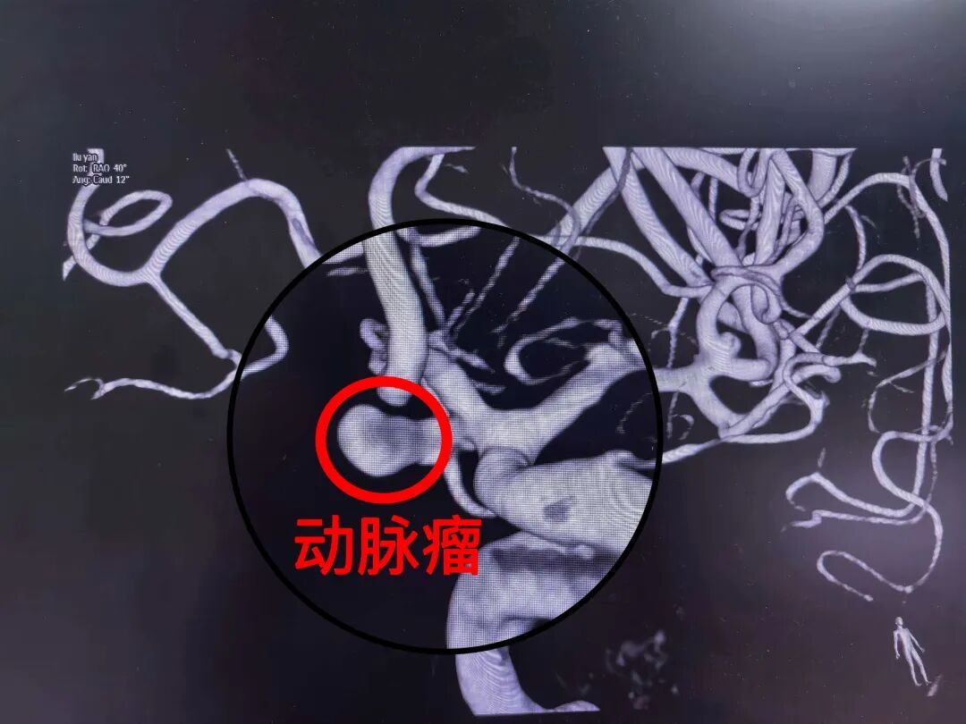 差点出大事！女子打麻将连续“自摸”，激动过头突然倒下