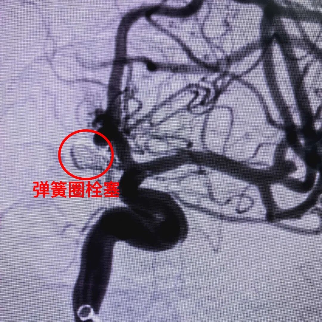 差点出大事！女子打麻将连续“自摸”，激动过头突然倒下