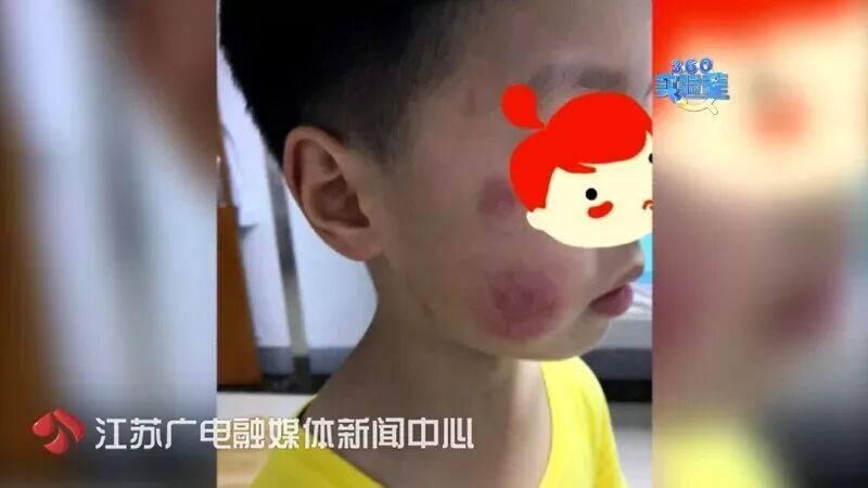 脸部严重糜烂!很多人都买过! 脸部严重糜烂!很多人都买过!