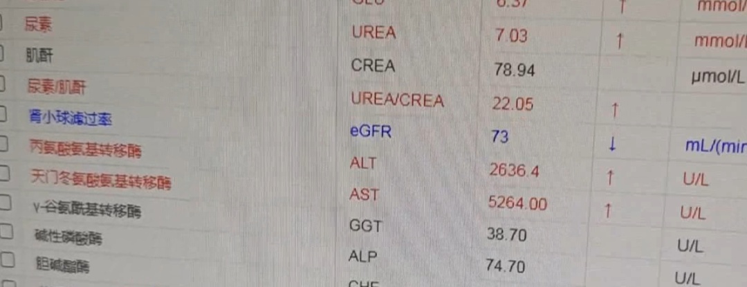 为“下火”轻信偏方，女子一口生吞致急性肝衰竭！差点丢了命