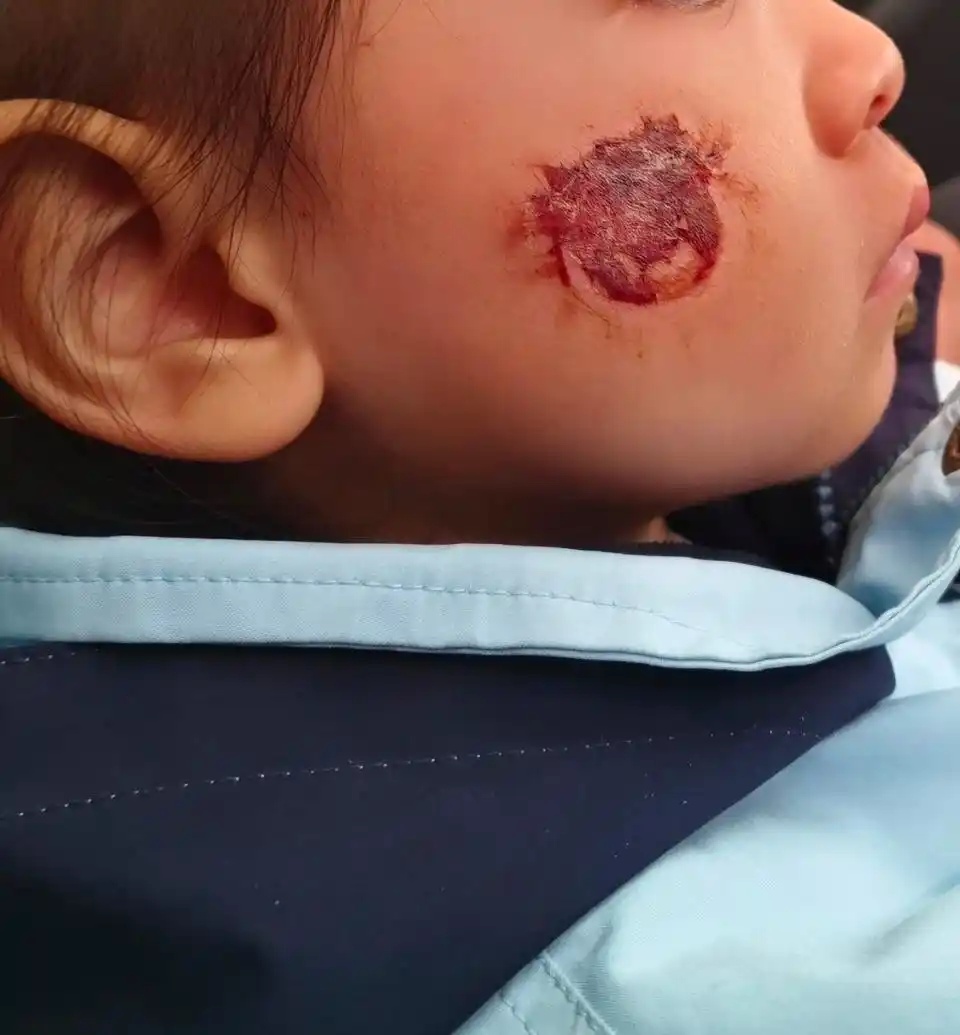 一张网购贴纸,引发皮肤溃烂?小心这些玩具暗藏风险→ 一张网购贴纸,引发皮肤溃烂?小心这些玩具暗藏风险→