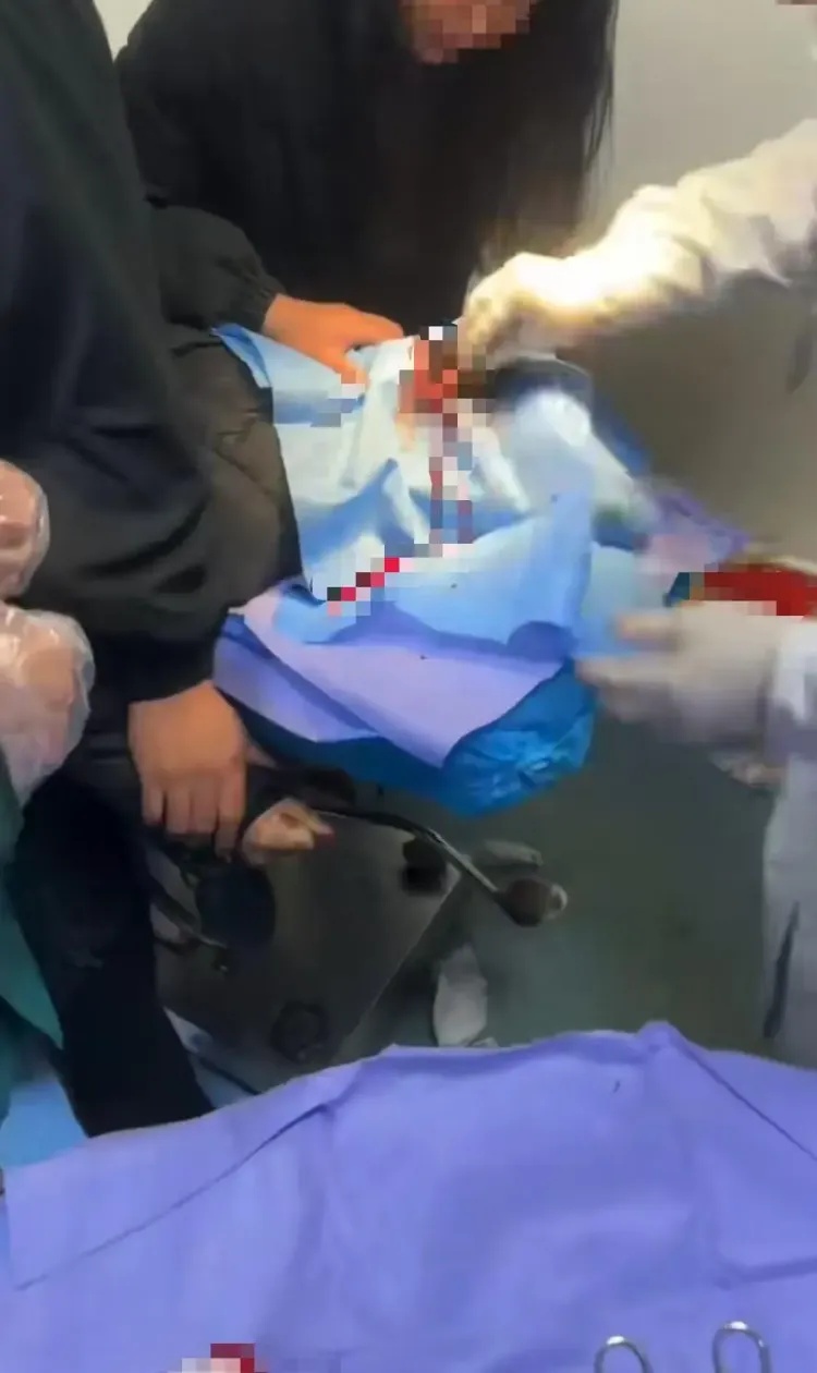 女子坐电瓶车摔倒头被鲨鱼夹扎破缝了9针:看过新闻,没想到发生在自己身上 女子坐电瓶车摔倒头被鲨鱼夹扎破缝了9针:看过新闻,没想到发生在自己身上