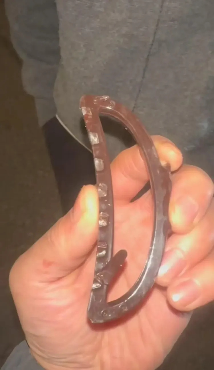 女子坐电瓶车摔倒头被鲨鱼夹扎破缝了9针:看过新闻,没想到发生在自己身上 女子坐电瓶车摔倒头被鲨鱼夹扎破缝了9针:看过新闻,没想到发生在自己身上