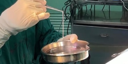 寄生虫在男子脑内“安家”21年!医生提醒:不吃生食、不喝生水 寄生虫在男子脑内“安家”21年!医生提醒:不吃生食、不喝生水