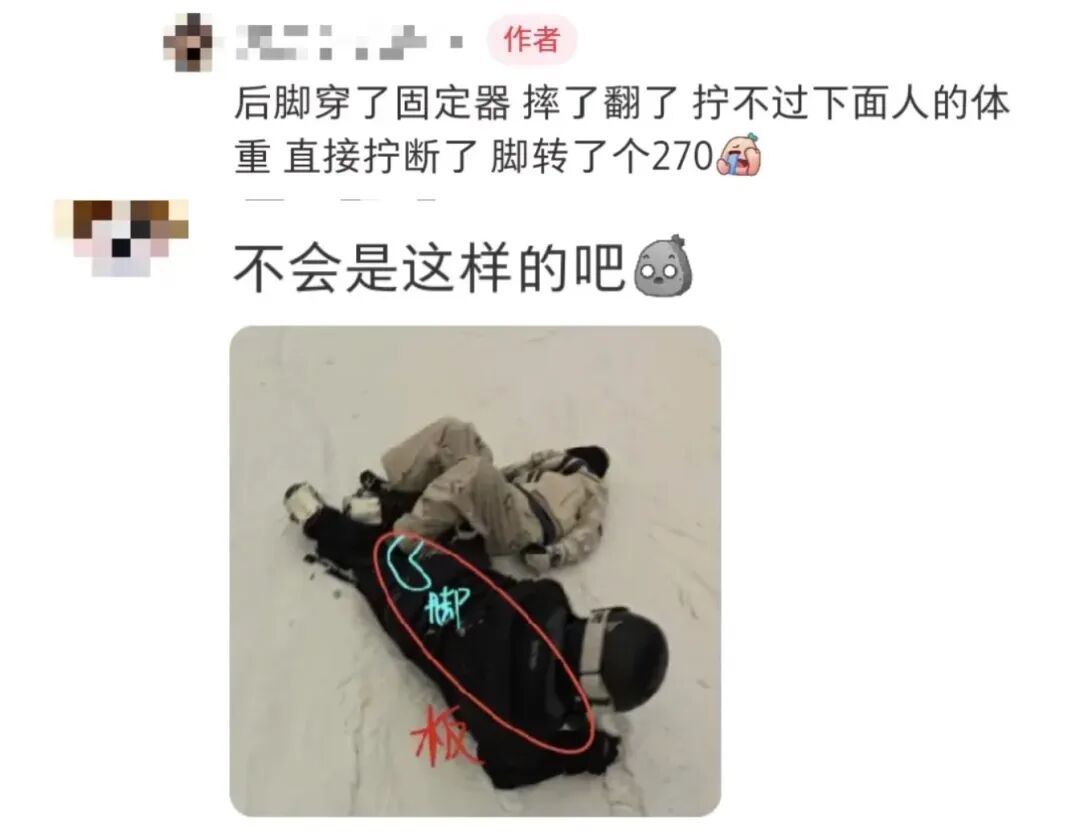 脚转了270°，隔屏看都疼！“踩人滑雪”直接“滑”进骨科……