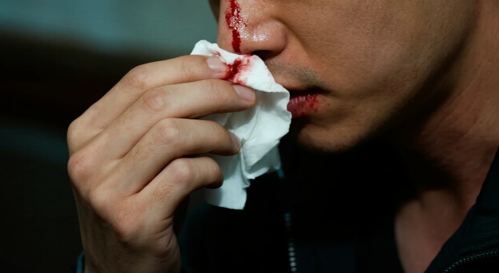 小心这种疾病!别只怪干燥上火 小心这种疾病!别只怪干燥上火