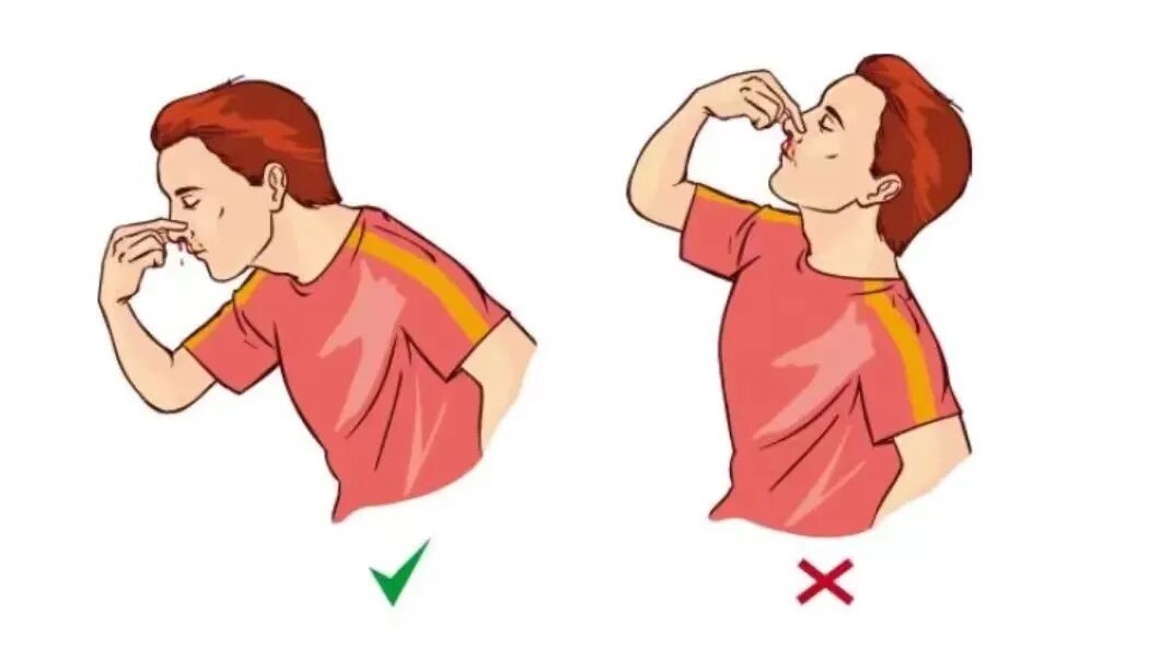 小心这种疾病!别只怪干燥上火 小心这种疾病!别只怪干燥上火