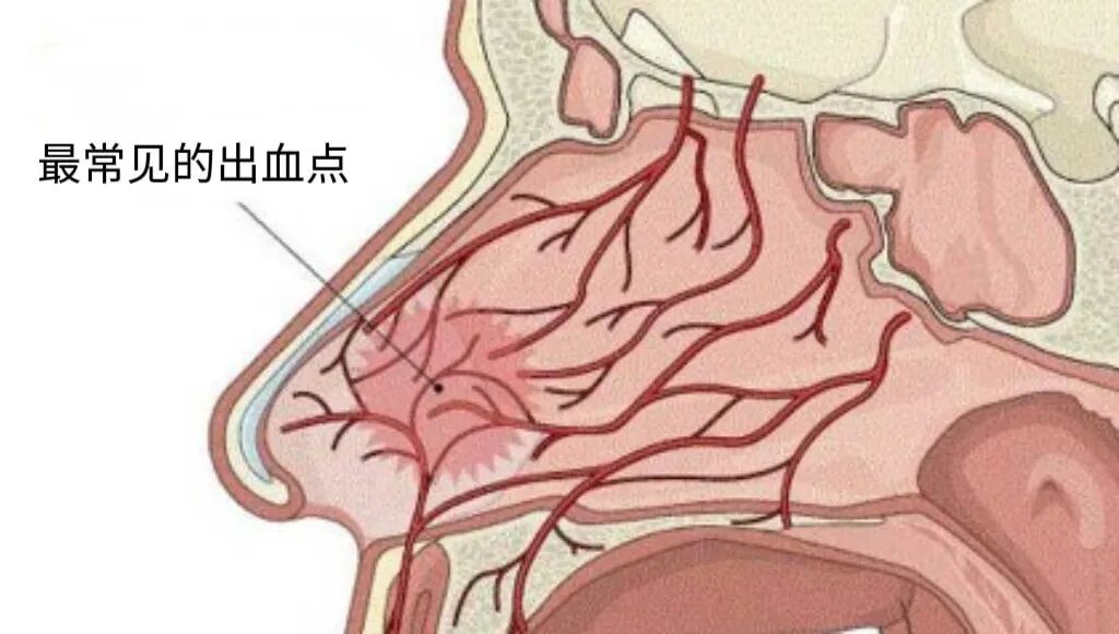 小心这种疾病!别只怪干燥上火 小心这种疾病!别只怪干燥上火