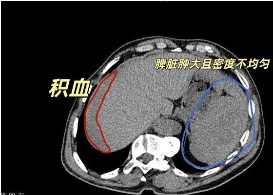 事发镇江!一男子遭遇严重车祸 事发镇江!一男子遭遇严重车祸