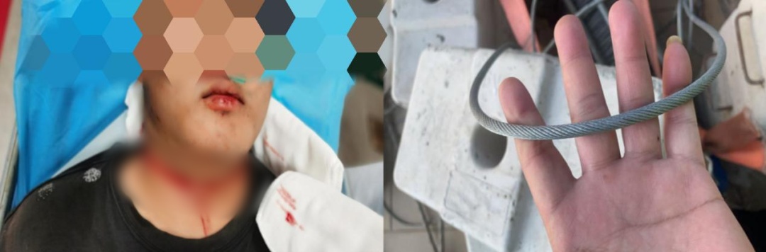 高空惊魂!钢丝绳突然断裂,18岁工人被“绞喉”30秒 高空惊魂!钢丝绳突然断裂,18岁工人被“绞喉”30秒