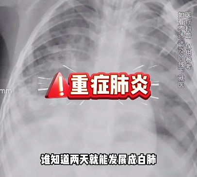 4岁女童持续发烧！不到24小时肺都白了，有这些症状立即就医