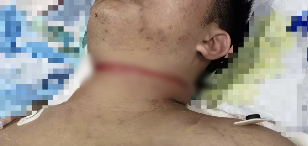 高空惊魂!钢丝绳突然断裂,18岁工人被“绞喉”30秒 高空惊魂!钢丝绳突然断裂,18岁工人被“绞喉”30秒