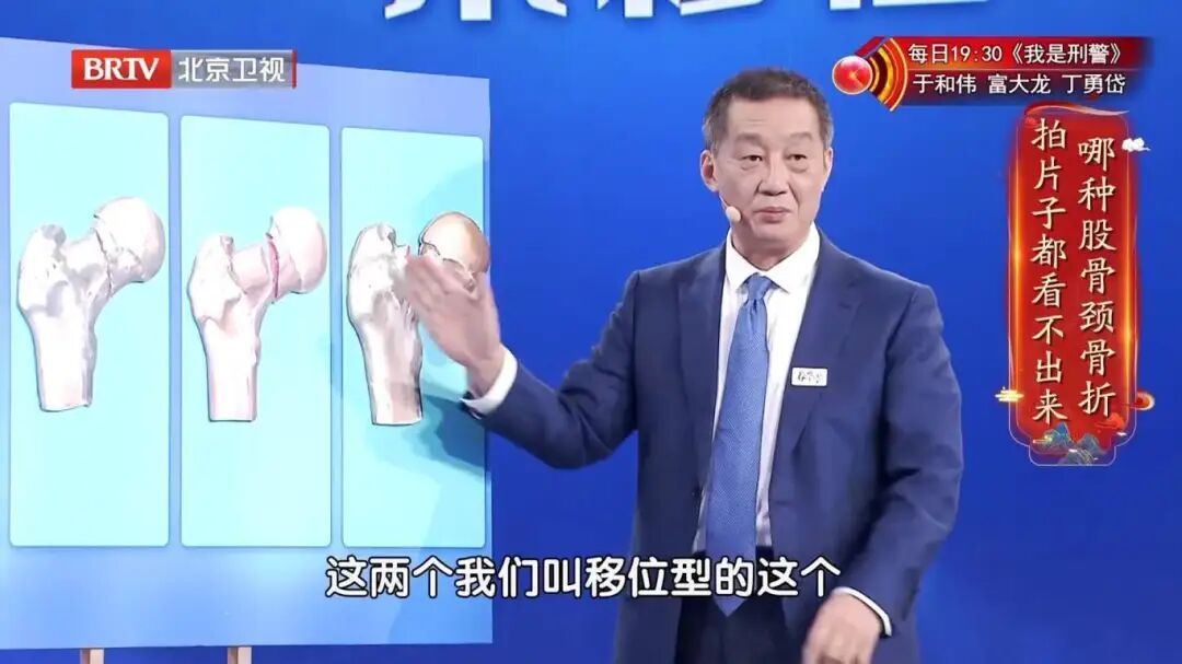 北京暴雪+道路结冰双预警！雪天路滑，警惕这种骨折，拍片子可能都看不出来→