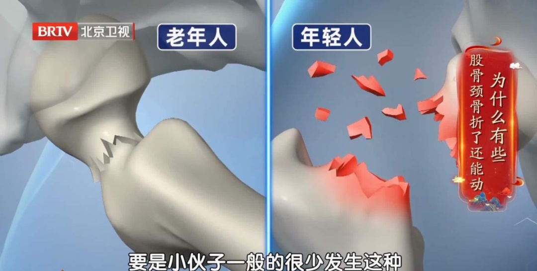 北京暴雪+道路结冰双预警！雪天路滑，警惕这种骨折，拍片子可能都看不出来→