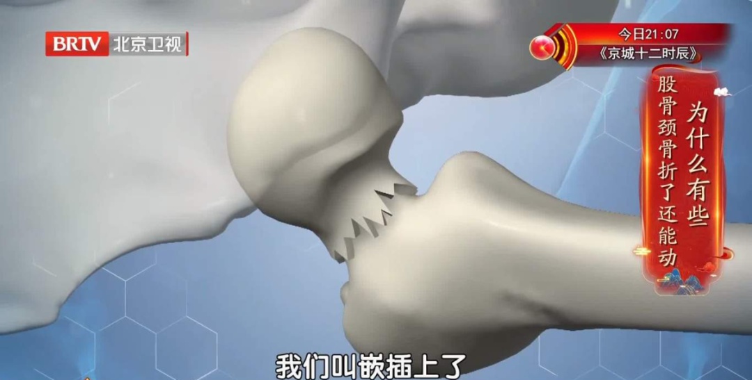 北京暴雪+道路结冰双预警！雪天路滑，警惕这种骨折，拍片子可能都看不出来→