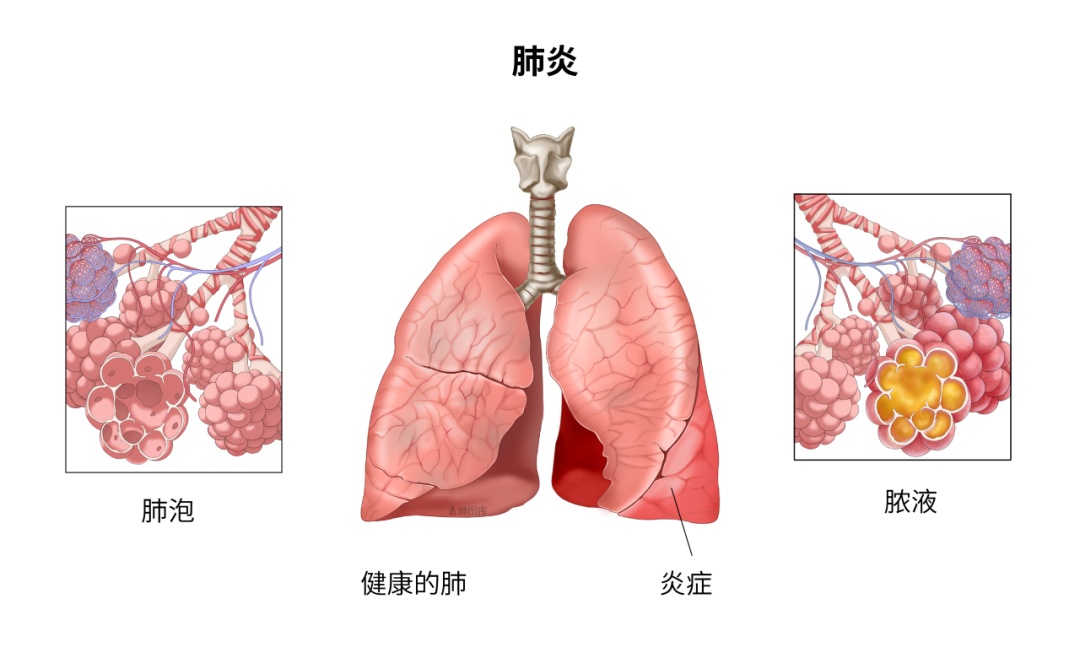 咳咳咳咳咳不停！这是为什么？