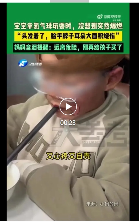 孩子手、脸都被烧伤！宝妈含泪提醒：这种玩具千万别买