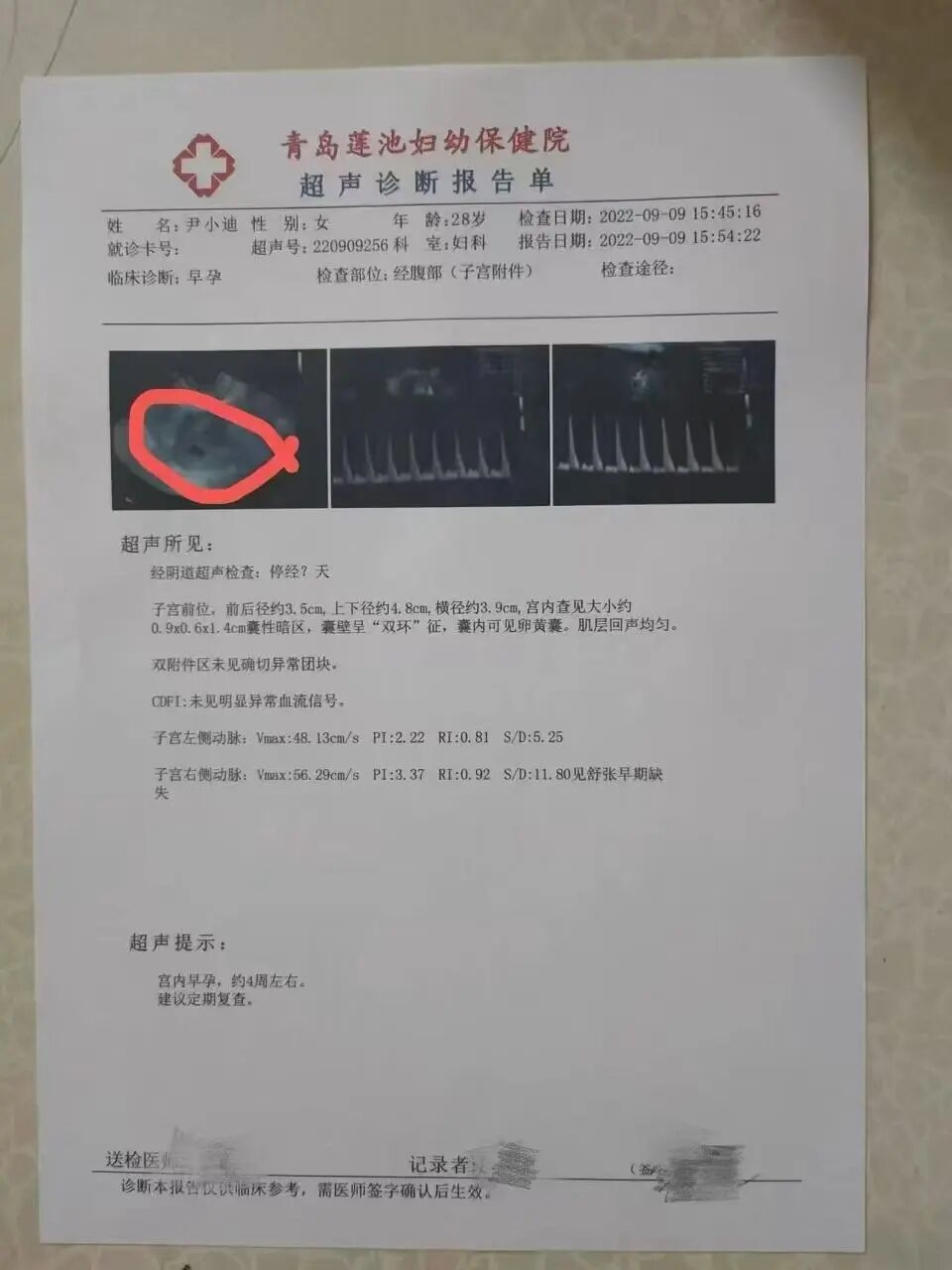 女子4年交往6名男子，6次假怀孕